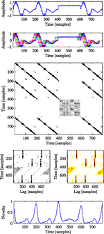 Unsupervised detection of music boundaries by time series structure features